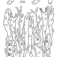 Attēlu rezultāti vaicājumam “Vuilleminia comedens”