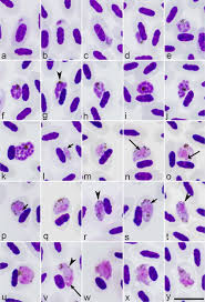 Attēlu rezultāti vaicājumam “undetermined plasmodium”