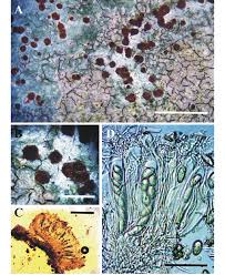Attēlu rezultāti vaicājumam “Trapelia coarctata”
