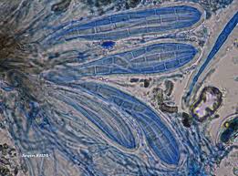 Attēlu rezultāti vaicājumam “Lecanactis abietina”