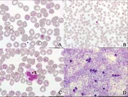 Attēlu rezultāti vaicājumam “Reticularia lobata plasmodium”