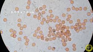 Attēlu rezultāti vaicājumam “Arcyria stipata spores”