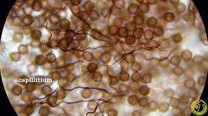 Attēlu rezultāti vaicājumam “Diderma crustaceum spores”