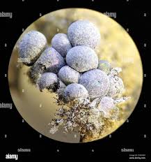 Attēlu rezultāti vaicājumam “Badhamia foliicola sessile”