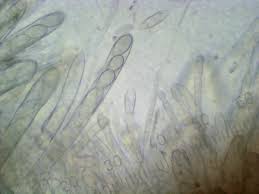 Attēlu rezultāti vaicājumam “Lachnellula willkommii”