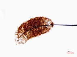 Attēlu rezultāti vaicājumam “Comatricha pulchella stalked”