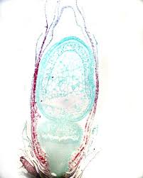 Attēlu rezultāti vaicājumam “Sphagnum angustifolium sporophyte”