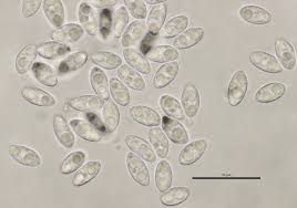 Attēlu rezultāti vaicājumam “Ombrophila violacea spores”