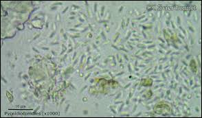 Attēlu rezultāti vaicājumam “Opegrapha rufescens”