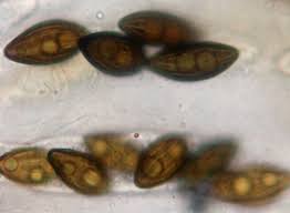 Attēlu rezultāti vaicājumam “Symphytocarpus trechisporus spores”