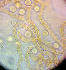 Attēlu rezultāti vaicājumam “Arcyria major macro”