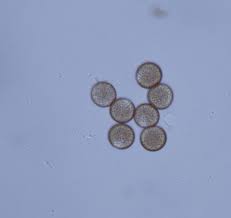 Attēlu rezultāti vaicājumam “Comatricha elegans stalked”