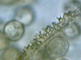 Attēlu rezultāti vaicājumam “Arcyria affinis stalked”