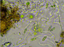 Attēlu rezultāti vaicājumam “Ramalina calicaris”
