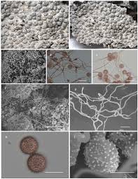 Attēlu rezultāti vaicājumam “Physarum bryomacrocarpum spores”
