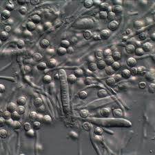 Attēlu rezultāti vaicājumam “Sclerophora pallida”