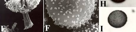 Attēlu rezultāti vaicājumam “Stemonitopsis subcaespitosa spores”
