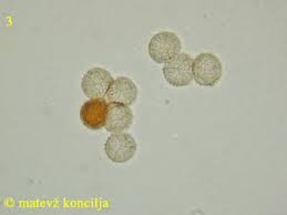Attēlu rezultāti vaicājumam “Cribraria rufa spores”
