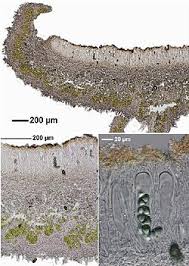 Attēlu rezultāti vaicājumam “Anaptychia ciliaris”