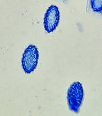 Attēlu rezultāti vaicājumam “Sowerbyella radiculata”