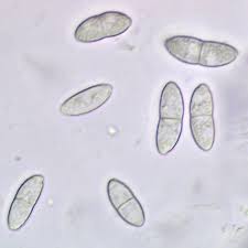 Attēlu rezultāti vaicājumam “Hypocreopsis lichenoides”