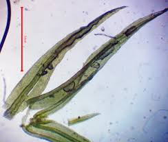 Attēlu rezultāti vaicājumam “Saelania glaucescens sporophyte”