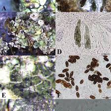 Attēlu rezultāti vaicājumam “Oligonema persimile spores”