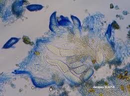 Attēlu rezultāti vaicājumam “Phlyctis agelaea”