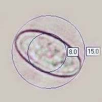 Attēlu rezultāti vaicājumam “Ombrophila violacea spores”