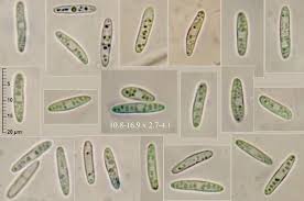 Attēlu rezultāti vaicājumam “Lachnum corticale”
