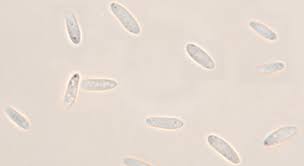 Attēlu rezultāti vaicājumam “Mollisia cinerea”