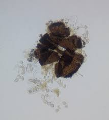 Attēlu rezultāti vaicājumam “Sawadaea tulasnei”