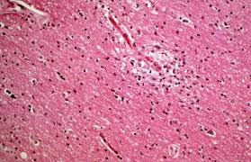 Attēlu rezultāti vaicājumam “Diachea muscorum plasmodium”