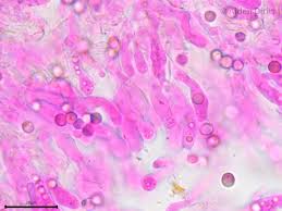 Attēlu rezultāti vaicājumam “Byssocorticium atrovirens”