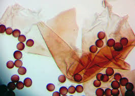 Attēlu rezultāti vaicājumam “Fuligo leviderma spores”