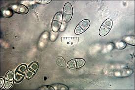 Attēlu rezultāti vaicājumam “Nectria peziza”