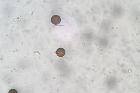 Attēlu rezultāti vaicājumam “Diderma crustaceum macro”