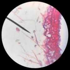 Attēlu rezultāti vaicājumam “Arcyria affinis young”