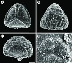 Attēlu rezultāti vaicājumam “Lycogala fuscoolearium spores”