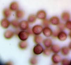 Attēlu rezultāti vaicājumam “Lycogala sphaeroconicum sessile”