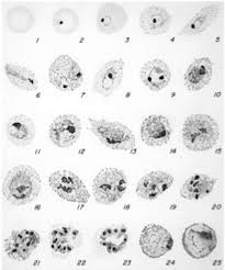 Attēlu rezultāti vaicājumam “Enteridium variabile plasmodium”
