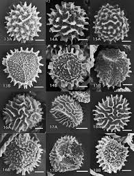 Attēlu rezultāti vaicājumam “Fossombronia wondraczekii spores”
