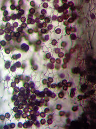 Attēlu rezultāti vaicājumam “Stemonitis lignicola spores”