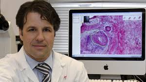 Dr. Lorenzo Ferri, director of thoracic surgery at McGill University Health Centre and a human stomach cancer specimen. Photo Credit: Pierre Dubois/McGill ... - 130701_4n6ii_rci-ferri_sn635