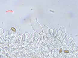 Attēlu rezultāti vaicājumam “Amaurochaete fusiformis macro”