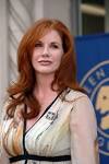 MELISSA GILBERT Plastic Surgery - Transformation