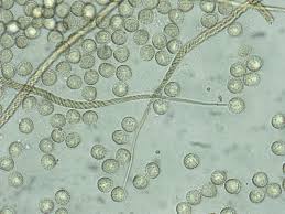 Attēlu rezultāti vaicājumam “Trichia crateriformis spores”