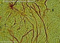 Attēlu rezultāti vaicājumam “Basidiodendron”