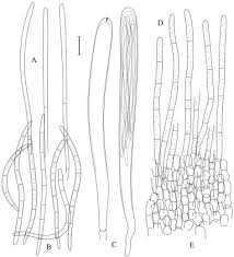 Attēlu rezultāti vaicājumam “Lachnum corticale”