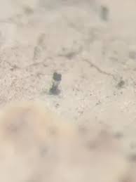 Attēlu rezultāti vaicājumam “Microcalicium disseminatum”